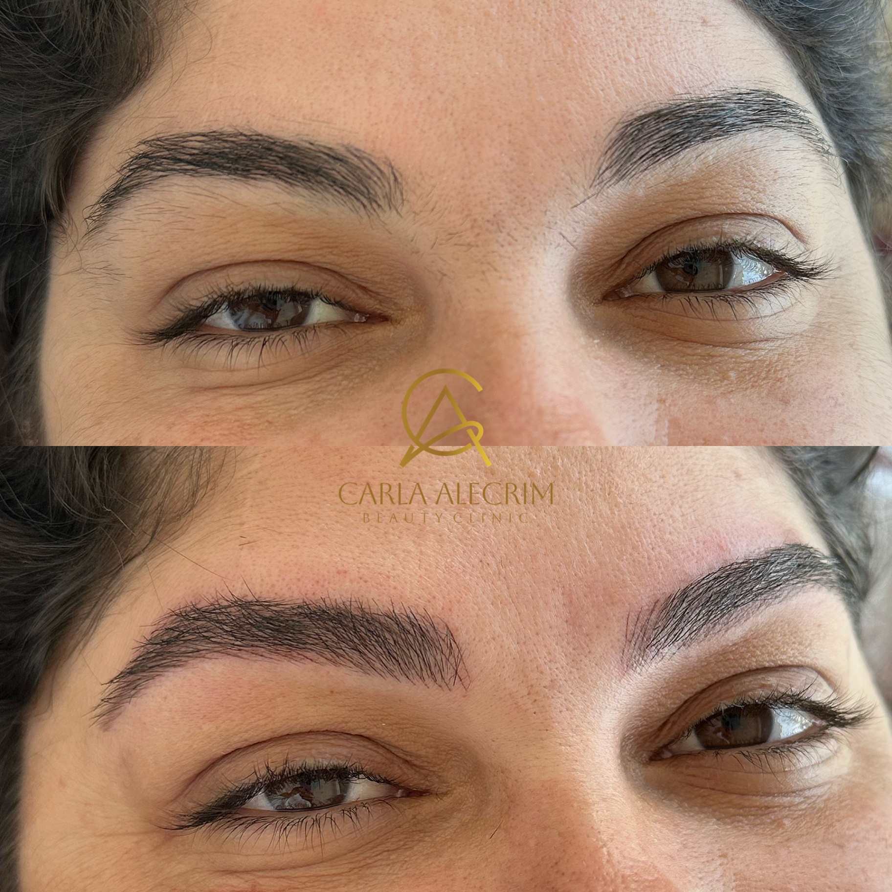 Antes e depois , Fios precisos e naturalidade