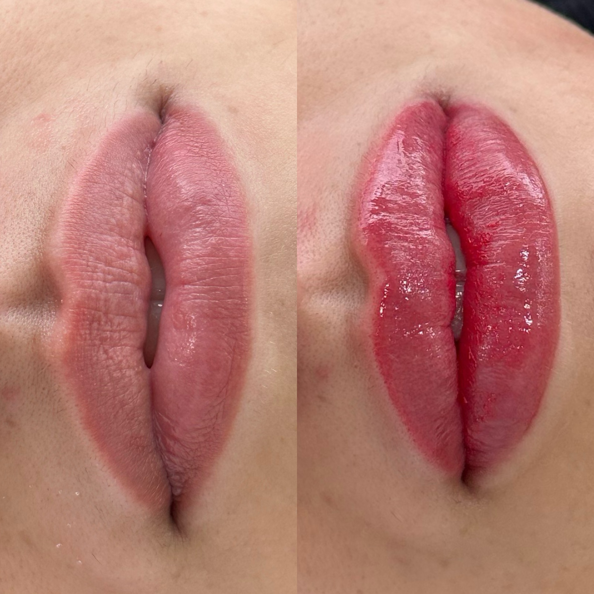 Antes e depois , Micropigmentação labial